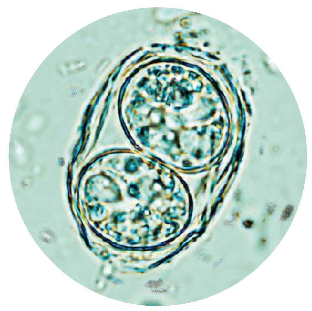 Смертоносные паразиты получают новую работу: модифицированный Toxoplasma gondii доставляет лекарства в мозг мышей.