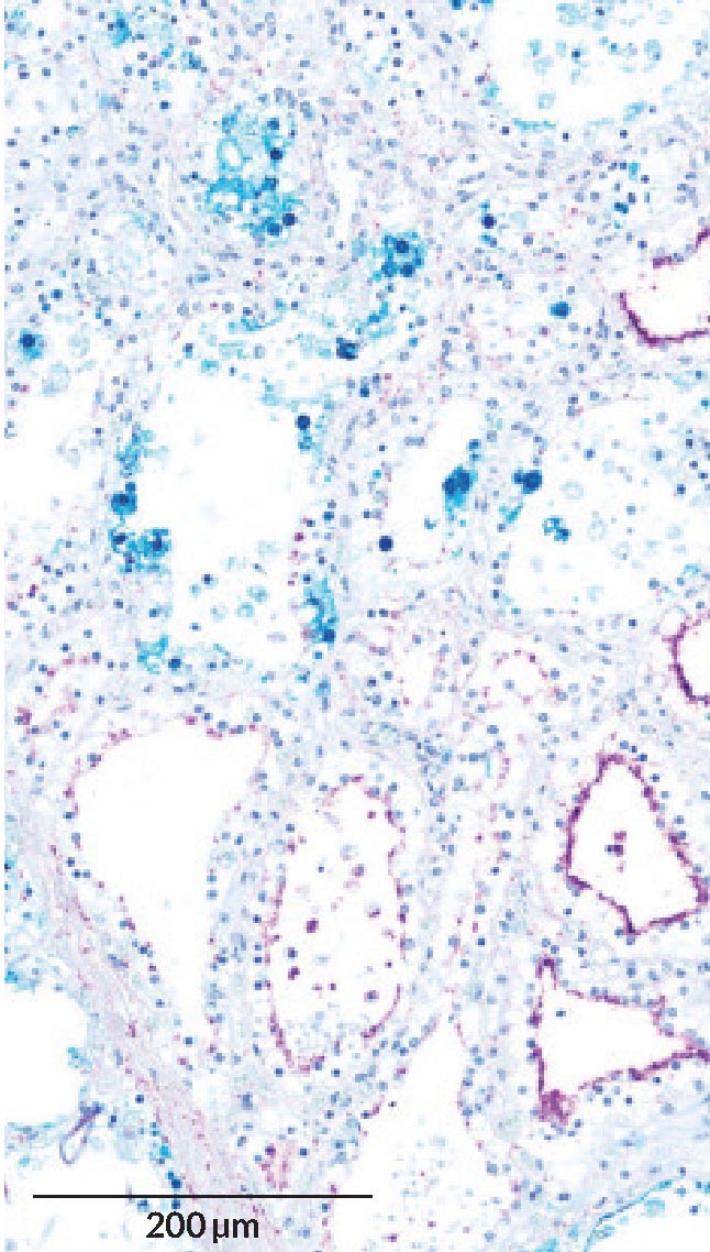Птичий грипп нацелился на молочные железы.